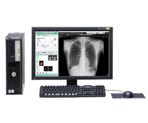 画像診断ネットワーク及びCR装置